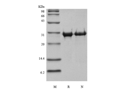 Recombinant Human Matrix metalloproteinase-14