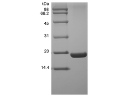 Recombinant Human UBE2I/UBC9 Protein, His