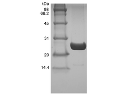 Recombinant Human Ubiquitin-conjugating Enzyme E2 K, His