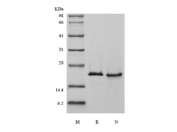 Recombinant Human Ubiquitin-conjugating Enzyme E2 D3, His