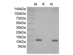 Recombinant Human Apolipoprotein-Serum Amyloid A1