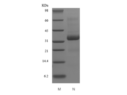 Recombinant Human Secreted Protein Acidic and Rich in Cysteine