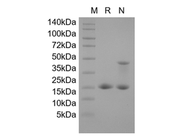Recombinant Human Cyclin-Dependent Kinase Inhibitor 2A, Isoform 1