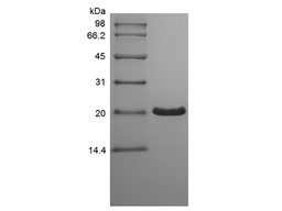 Recombinant Human Trefoil Factor 1