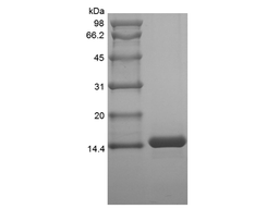 Recombinant Human Melanoma Inhibitor Activity Protein 2