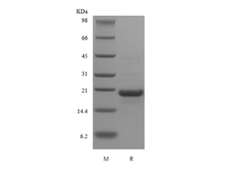 Recombinant Human soluble CD23