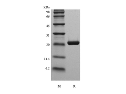 Recombinant Murine Cardiotrophin1