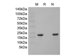 Recombinant HBV Surface Antigen-preS1