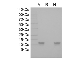 Recombinant HBV Surface Antigen-preS2