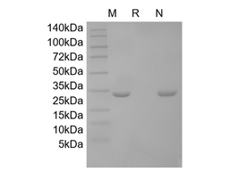 Recombinant Human Cardiotrophin-1