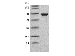 Recombinant Human Cardiac muscle troponin T