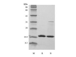 Recombinant Human Fatty acid binding protein3