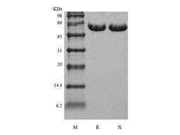 Recombinant Human Osteopontin/OPN