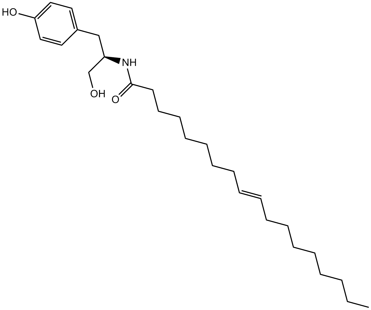 OMDM-2