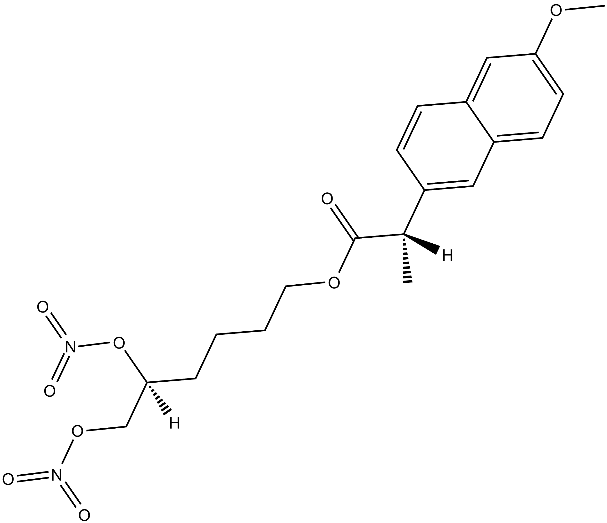 NCX 466