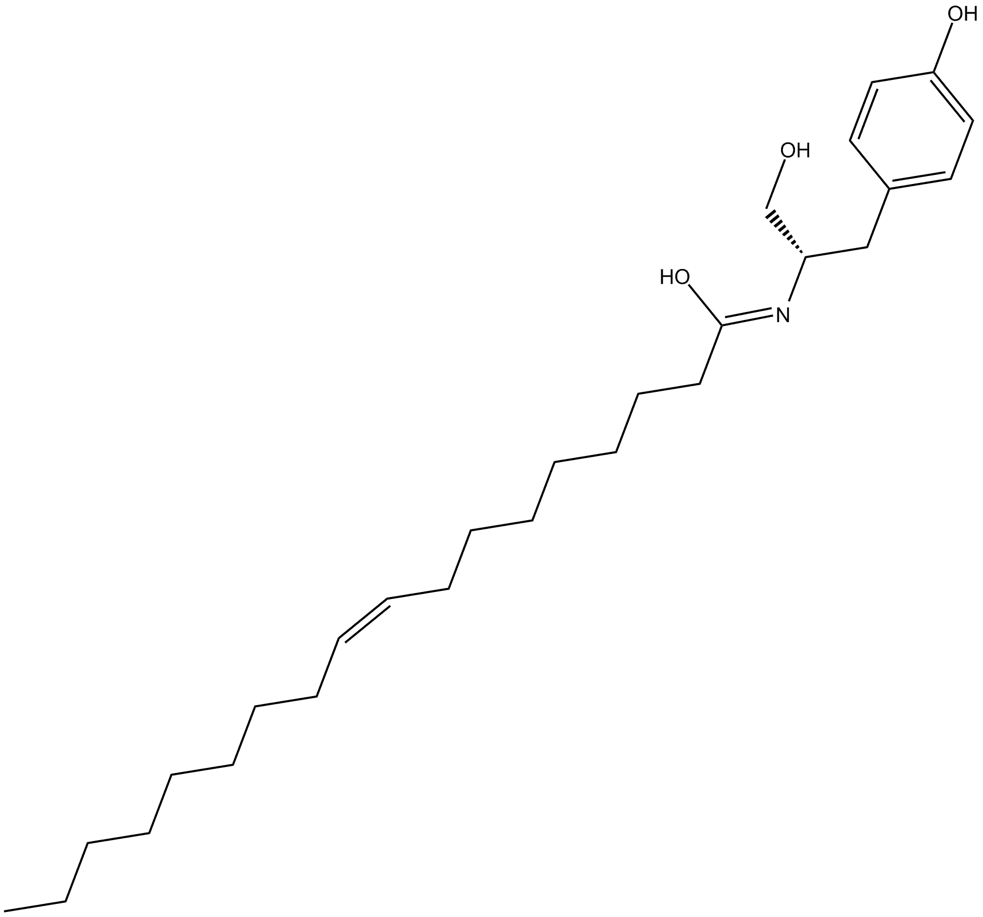 OMDM-1