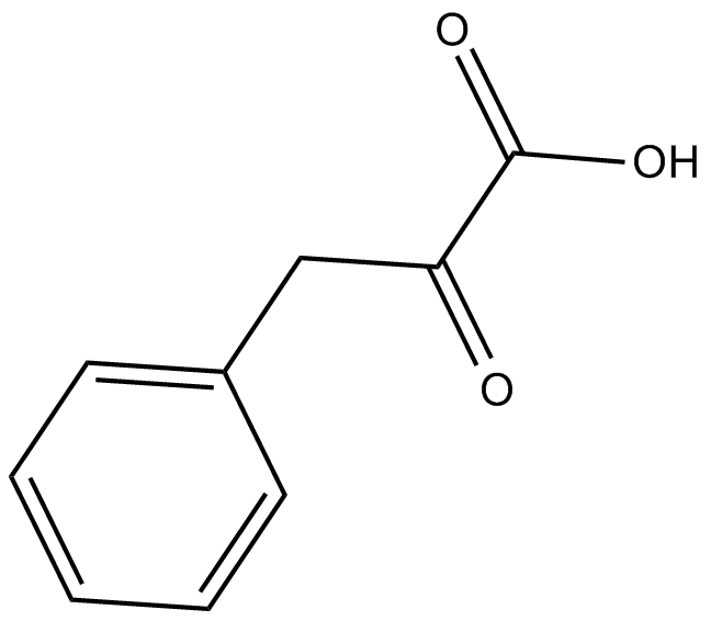 Phenylalanine & tyrosine metabolism