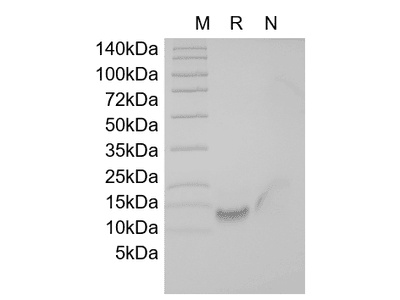 Recombinant Human BCMA/TNFRSF17