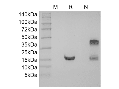 Recombinant Human soluble Tumor Necrosis Factor-Related Apoptosis-inducing Ligand Receptor-2/TNFRSF10B