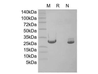 Recombinant Murine Oncostatin-M