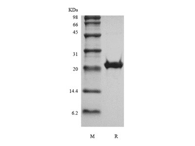 Recombinant Human Fibroblast Growth Factor 16
