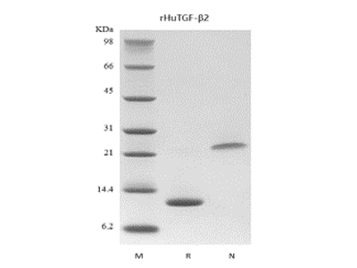 Recombinant Human Transforming Growth Factor - beta 2