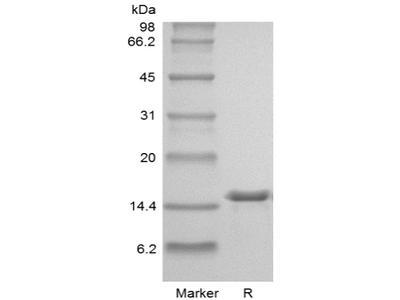 Recombinant Human Interleukin-2 GMP