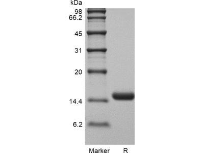 Recombinant Human Interleukin-3 GMP