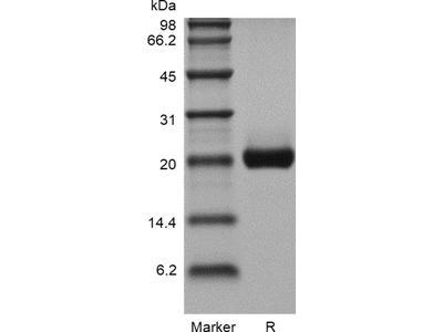 Recombinant Human Interleukin-6 GMP