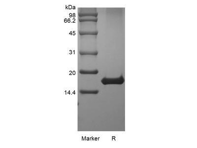 Recombinant Human Interleukin-21 GMP