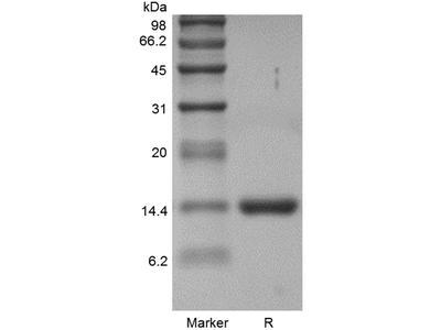 Recombinant Human Granulocyte-Macrophage Colony Stimulating Factor GMP