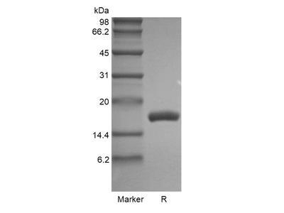 Recombinant Human Fms-related Tyrosine Kinase 3 Ligand GMP