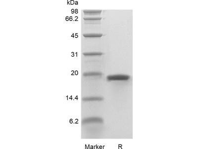 Recombinant Human Keratinocyte Growth Factor-1/FGF-7 GMP