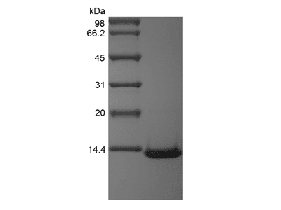 Recombinant Human Monocyte Chemotactic Protein-3/CCL7