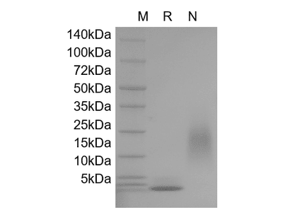 Recombinant Human Hemofiltrate CC Chemokine-1/CCL14