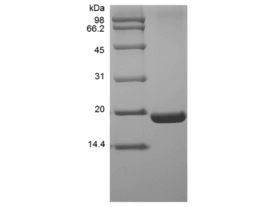 Recombinant Human UBE2I/UBC9 Protein, His