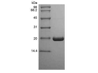 Recombinant Human Ubiquitin-conjugating Enzyme E2 C, His