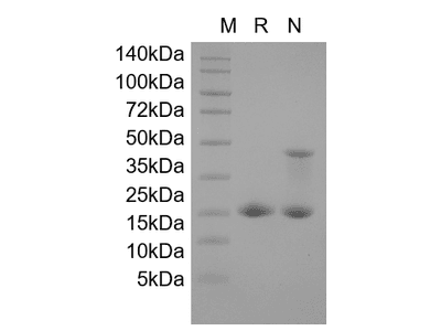 Recombinant Human Cyclin-Dependent Kinase Inhibitor 2A, Isoform 1