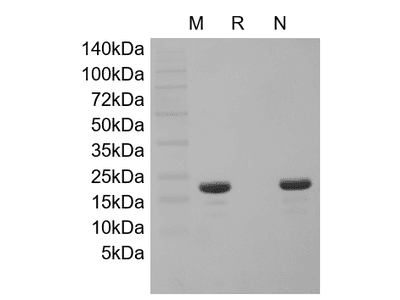 Recombinant HBV Surface Antigen-preS1