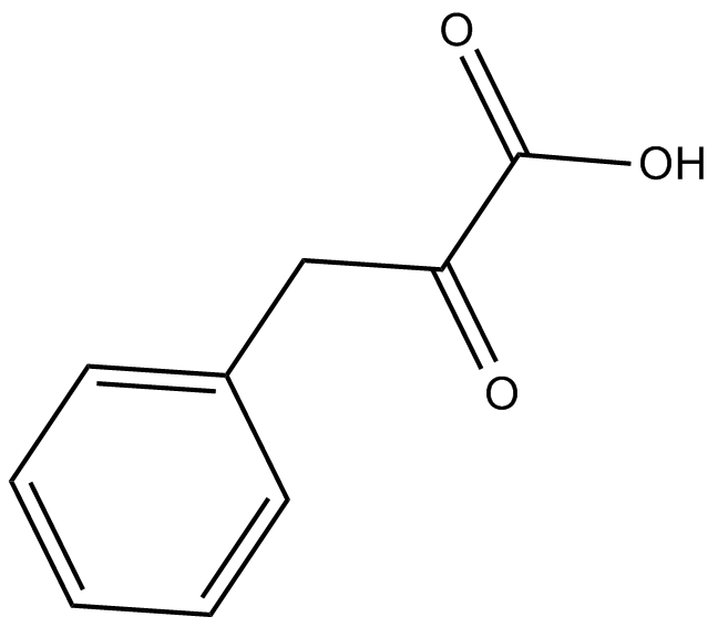 Phenylalanine & tyrosine metabolism